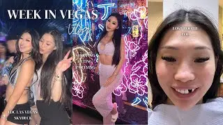 Vegas Vlog | EDC Skydeck, I LOST MY TOOTH, Buying $300k Jacob & Co Bugatti Chiron watch