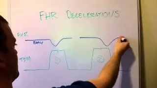 Fetal Heart Rate Decelerations (Early, Late, Variable)