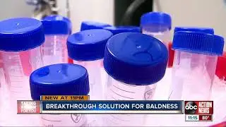 California lab creating 'cure' for baldness using cell cloning process