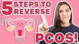 What Causes PCOS? How to REVERSE PCOS! (Yes, It Is Possible!)