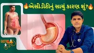 એસિડિટી પિત્ત અને પેટ ની ચરબી નો સંબંધ - ગુજરાતી માં સચોટ માહિતી #acidity #gerd #gastroenterologist
