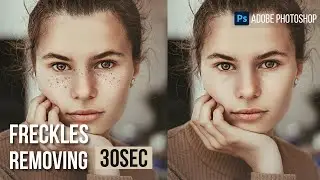 Dark Spots | Freckles remove Quickly in photoshop | Spot healing brush tool |  30sec | #shorts