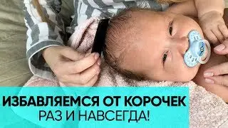 КАК УБРАТЬ КОРОЧКИ НА ГОЛОВЕ У МАЛЫША? Пошаговая инструкция для родителей. Ника Болзан