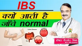 IBS क्यों आती है जाँचे normal || ANSWERS TO YOUR QUESTIONS ABOUT ULCERATIVE COLTIS