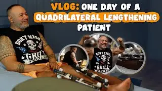 ONE DAY OF A QUADRILATERAL LENGTHENING PATIENT