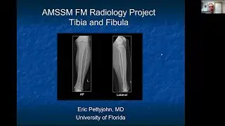 Tibia and Fibula | MSK Radiology: X-Ray Educational Modules for Primary Care Residents