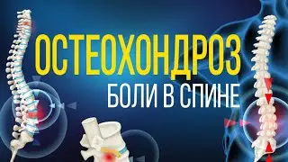 Остеохондроз - реален? О ЧЕМ МОЛЧАТ ВРАЧИ