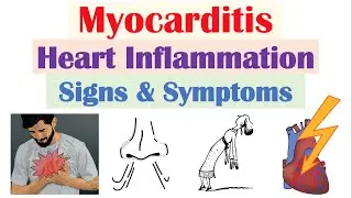 Myocarditis (Heart Inflammation) Signs & Symptoms (& Why They Occur)