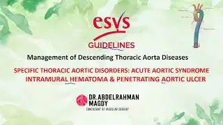 Guidelines In Lines Management of DTA Diseases: Acute Aortic Syndrome : IMH, PAU and Ruptured DTAA