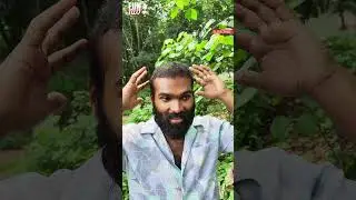 കിളിത്ത് 👦|HAIR TRANSPLANT | Fun Da |Malayalam Comedy |Shorts|