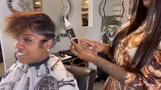 How to TREAT Seborrheic Dermatitis@CRAZYABOUTANGEL