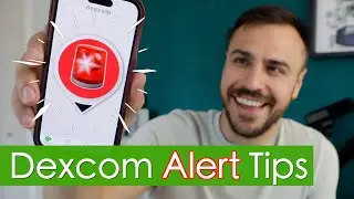 7 Dexcom G7 Alert Settings You Need to Know About