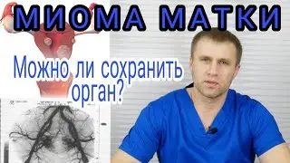 Миома. Методы лечения.