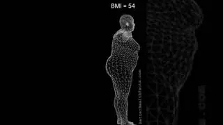 BMI Calculator : Measure your Obesity