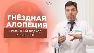 ГНЕЗДНАЯ АЛОПЕЦИЯ. Почему выпадают волосы и как с этим бороться?