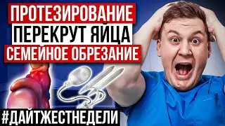 ОБНАРУЖИЛ ШАРИКИ В ПОЛОВОМ ЧЛЕНЕ | ДАЙДЖЕСТ НЕДЕЛИ