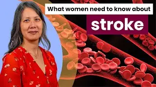 What women need to know about stroke