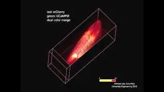 Swept Confocally Aligned Planar Excitation (SCAPE) Microscopy