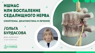 Ишиас или воспаление седалищного нерва. Симптомы, диагностика и лечение | Ольга Бурдасова