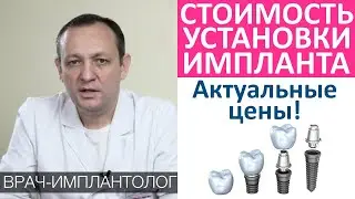 Сколько стоит установить зубной имплант. Цена имплантации.Из чего состоит стоимость зубного импланта