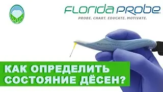 Как определить состояние дёсен?