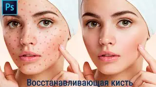 Инструмент восстанавливающая кисть в фотошопе , убираем прыщи на коже , Photoshop, Урок 5