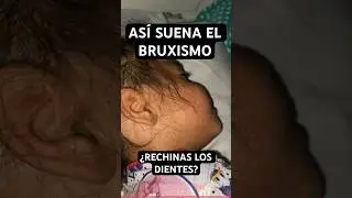 ¿Tu HIJO/A RECHINA los DIENTES al DORMIR? 📢 Así suena el BRUXISMO INFANTIL