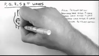 ECG 2 - P,Q,R,S & T Waves