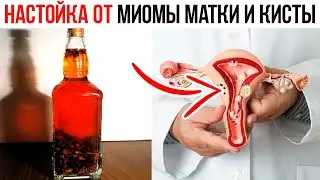 НАСТОЙКА ОТ МИОМЫ МАТКИ И КИСТЫ