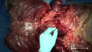 Thoracic Cavity Overview