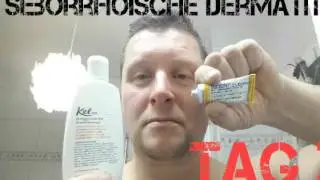 ✔SEBORRHOISCHE DERMATITIS  bekämpfen in 3 Tagen