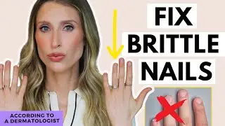 Fix Brittle Nails | How to Naturally Grow Stronger Nails | Dr. Sam Ellis