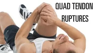 Quadriceps tendon rupture: Mechanism of injury and treatment options