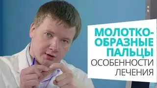 Молоткообразные пальцы: особенности лечения доктор Алексей Олейник #footclinic