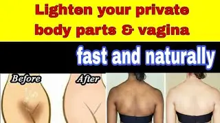 Lighten your private body parts | Underarms, Knees &......