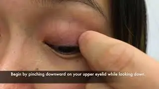 Dry Eye Treatment