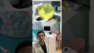 👁️ Ячмень | Как правильно лечить и что провоцирует образование | Как избавиться навсегда ⁉️