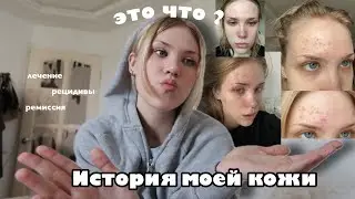 Мне ИСПОРТИЛИ кожу?? *лечу кожу 10 лет и уже не вывожу*help