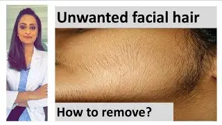 How to remove facial hair | unwanted facial hair | causes|treatment|Dermatologist| Dr. Aanchal Panth