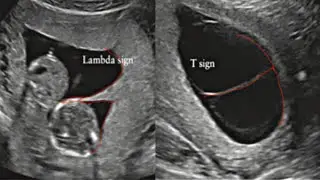 VISUOG Visual Encyclopedia for Ultrasound in Obstetrics & Gynecology