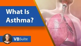 What Is Asthma? | Visible Body