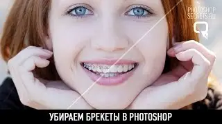 Убираем брекеты в photoshop