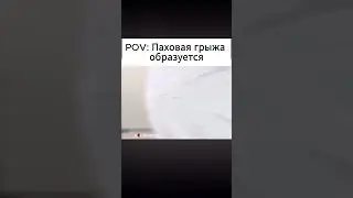 Образование паховой грыжи 😅