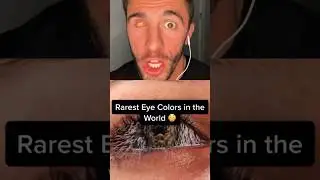 THE RAREST EYEBALL COLORS 😳