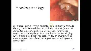 Lecture 12 part 7: measles mumps rubella