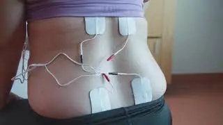 Using TENS for labour pain | Physiotherapy | Mater Mothers