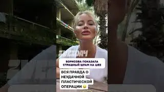 Что произошло? 🤯 Борисова показала страшный шрам на шее