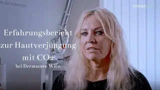 Erfahrungsbericht zur Hautverjüngung mit CO2 Laser bei Dermacare Wien