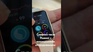 Сердечник сравнил показания фитнес - часов Huawei band 9 и медицинского оборудования (холтер)