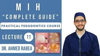 Lecture 11 : MIH " Molar Incisor Hypomineralization " : The Complete Guide | كورس بيدو عملي